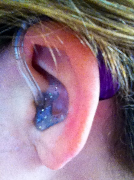 purple hearing aid with sparkly mold on a caucasian person's ear. Light brown hair is peeking out over ear.