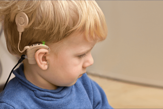 Close-up of a cochlear implant external processor worn behind the ear with transmitter on the head